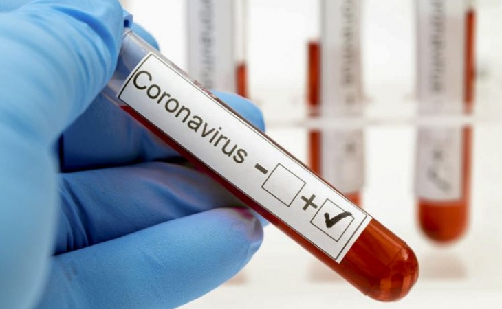 İranda son sutkada koronavirusdan 119 nəfər vəfat edib