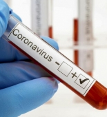 İranda son sutkada koronavirusdan 119 nəfər vəfat edib