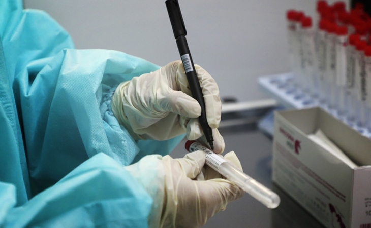 Pakistanda son sutkada koronavirusdan 208 nəfər ölüb