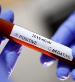 Belarusda koronavirusdan ölənlərin sayı 387 nəfərə çatıb