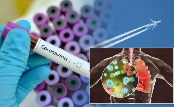Dünyada koronavirusa yoluxan 565 min nəfər həyatını itirib