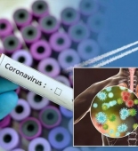 Dünyada koronavirusa yoluxan 565 min nəfər həyatını itirib