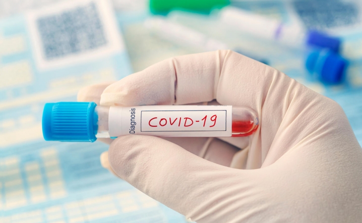 Dünyada koronavirus: qışda yeni bir xəstəlik olacaqmı?