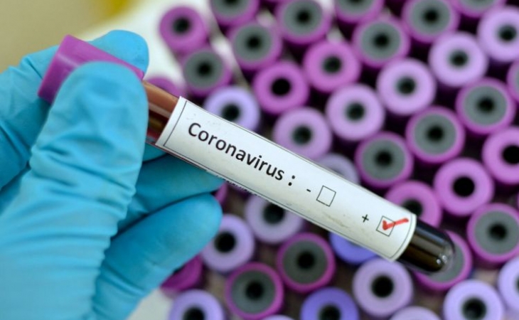İsraildə koronavirusa yoluxanların sayı 14 882 nəfərə yüksəlib