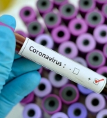 İsraildə koronavirusa yoluxanların sayı 14 882 nəfərə yüksəlib