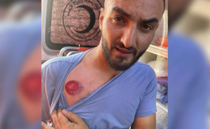 İsrail-Fələstin qarşıdurmasında türkiyəli jurnalist yaralandı - Foto
