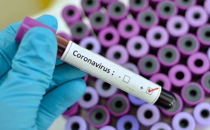 Ukraynada koronavirusa yoluxanların sayı 12 minə yaxınlaşıb