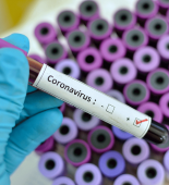 Ukraynada koronavirusa yoluxanların sayı 12 minə yaxınlaşıb