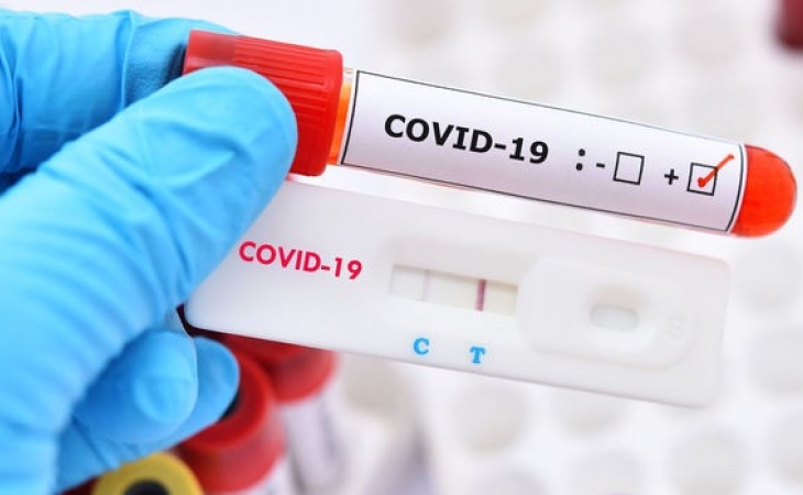 Bu gün koronavirusdan 2 nəfər öldü - SON STATİSTİKA