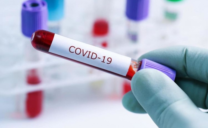 ABŞ-da koronavirusdan ölənlərin sayı 85 mini ötüb