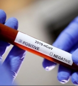 Britaniyada son sutkada koronavirusdan 428 nəfər ölüb