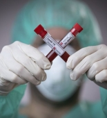 İranda koronavirusdan ölənlərin sayı 7 mini ötüb