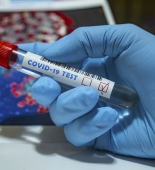 Gürcüstanda azərbaycanlıların yaşadığı kənddə 54 nəfər koronavirusa yoluxub
