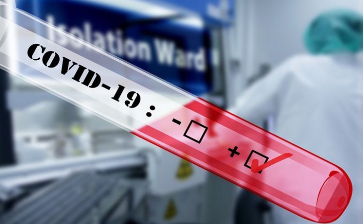Britaniyada son sutkada koronavirusdan 351 nəfər ölüb