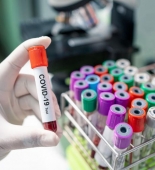 Almaniyada son sutkada koronavirusdan 10 nəfər ölüb