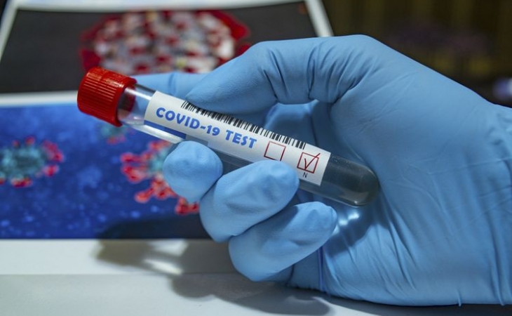 Rusiyada koronavirusdan ölənlərin sayı 4 min nəfəri keçib