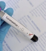 ABŞ-da son sutkada 24 146 nəfər koronavirusa yoluxub, 967 nəfər ölüb
