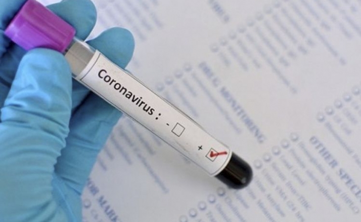 Almaniyada son sutkada 333 nəfər koronavirusa yoluxub