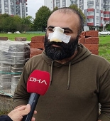 DƏHŞƏT! - Azərbaycanlı iş adamının burnunu PİTBUL QOPARDI