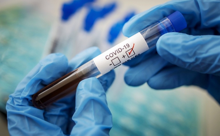 G20 sammitində koronavirusa ilk yoluxma halı qeydə alındı
