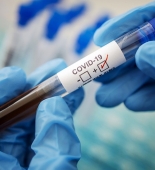 G20 sammitində koronavirusa ilk yoluxma halı qeydə alındı