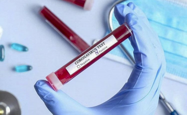 ABŞ-ın 14 ştatında koronavirusa yoluxma kəskin artıb