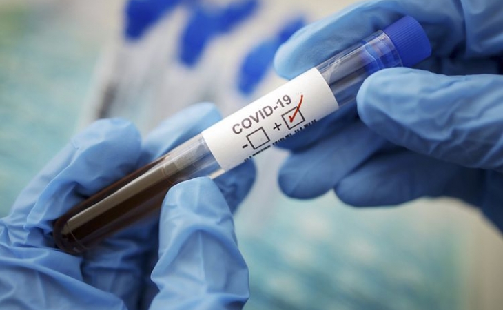 Hindistanda bir sutkada 396 nəfər koronavirusdan ölüb